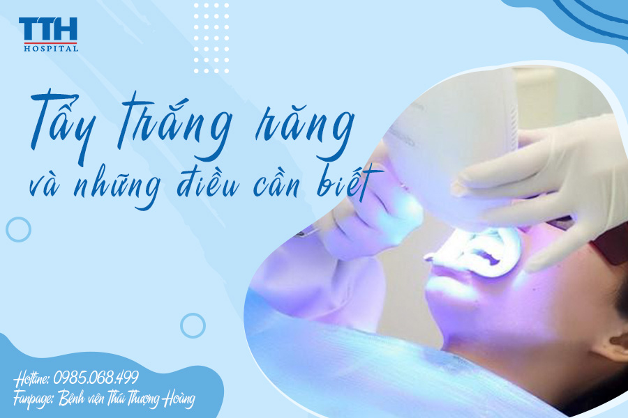 Tẩy trắng răng và những điều cần biết